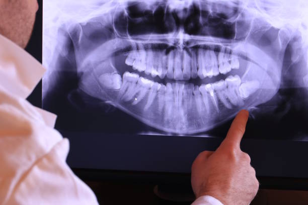 Best Emergency Dental Care for Trauma or Injury in Springdale, AR