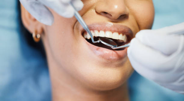 Best Walk-In Emergency Dentist in Springdale, AR