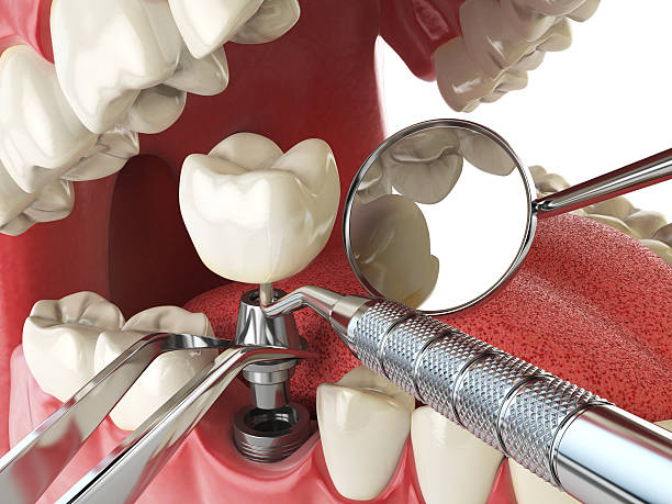Best Emergency Orthodontic Repairs in Springdale, AR